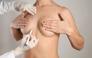 breast augmentation methods with surgery