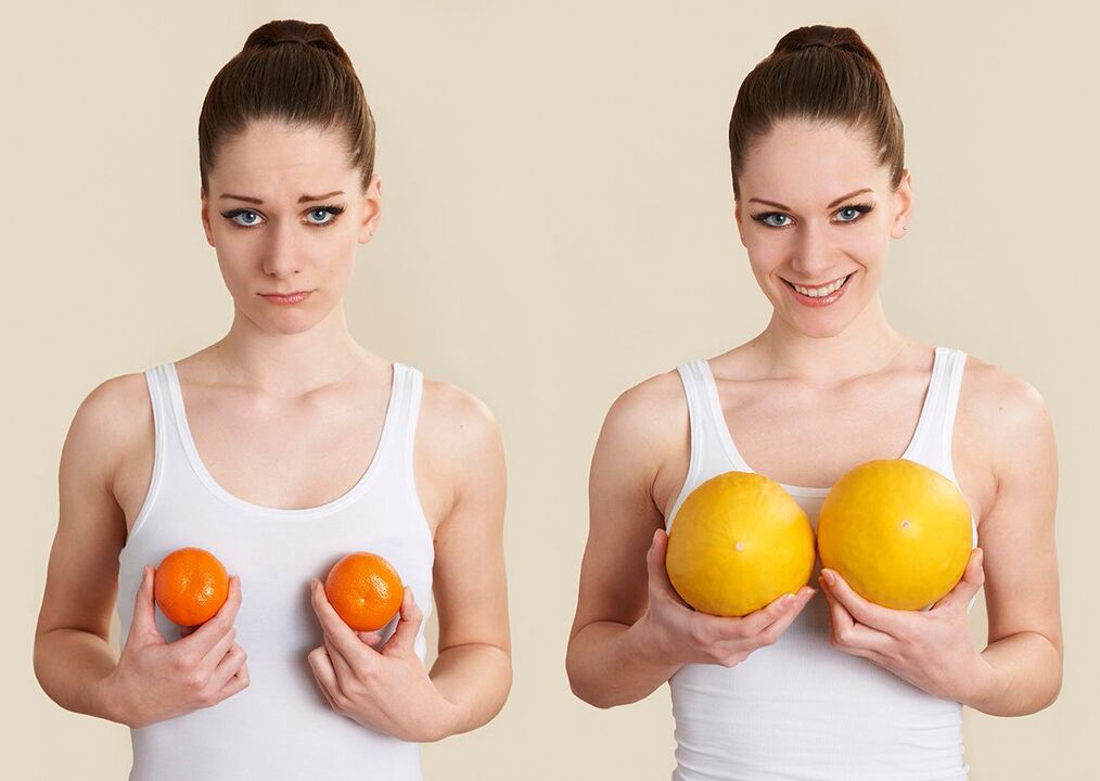 Breast shape correction