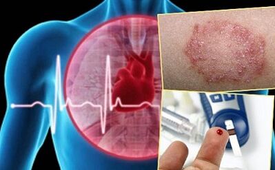 Contraindications to lipolifting