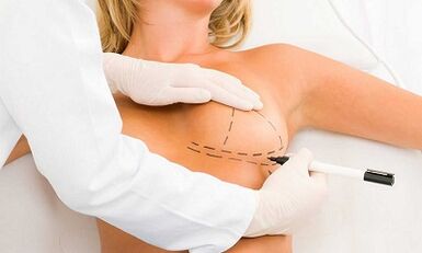 How to increase the brains of implants