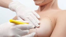 breast enlargement surgery